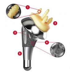 AltiVateâ„¢ Anatomic