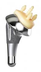 AltiVateâ„¢ Anatomic Product