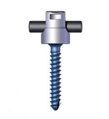 DENALIÂ® Mini Spinal System Product