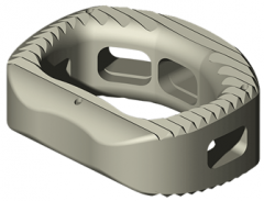 ALEUTIANÂ® Anterior-Lumbar (ALIF) Interbody System Product