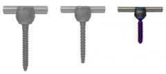 MESAÂ® Mini Spinal System Product