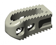 ALEUTIANÂ® Posterior-Lumbar (PLIF) Interbody System Product