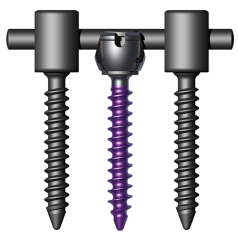 MESAÂ® Degenerative Spinal System Product