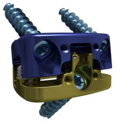SAHARAÂ® AL Expandable Stabilization System Product