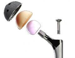 ExprtÂ® Revision Hip Product