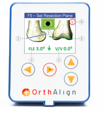 KneeAlignÂ® Technology Product