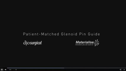 Match Point Systemâ„¢ Product