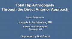 Taperfillâ„¢ Hip System Product