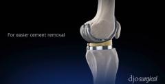 COBALTâ„¢ BONE CEMENT Product